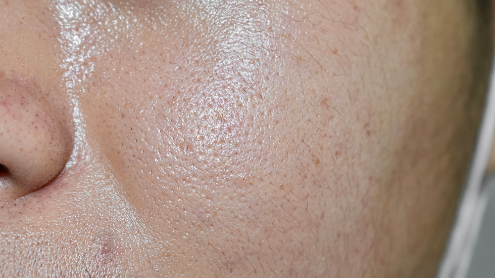 Hydrafacial Treatment - symmetrica Blog